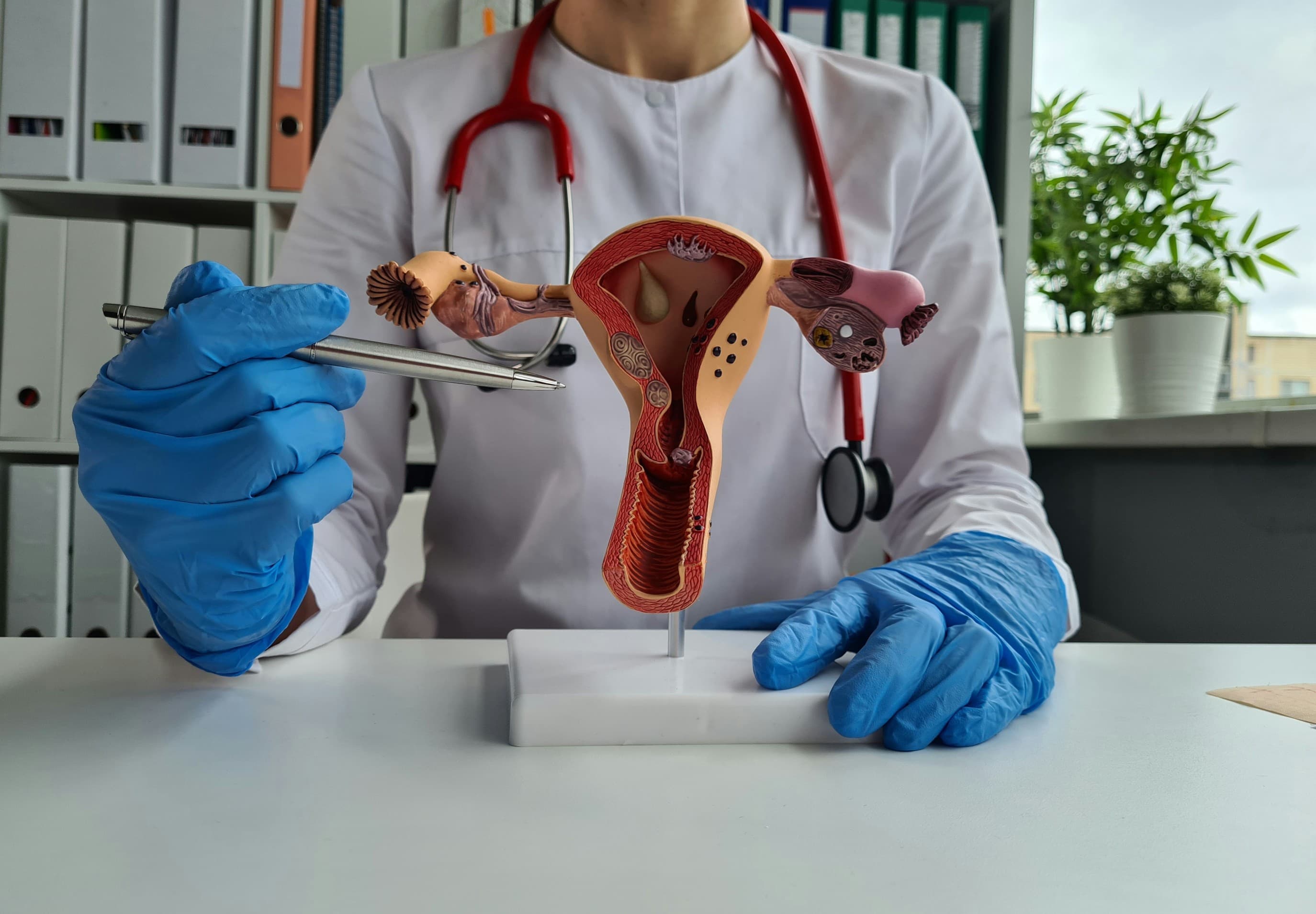 Mysterious polycystic ovary syndrome (PCOS)