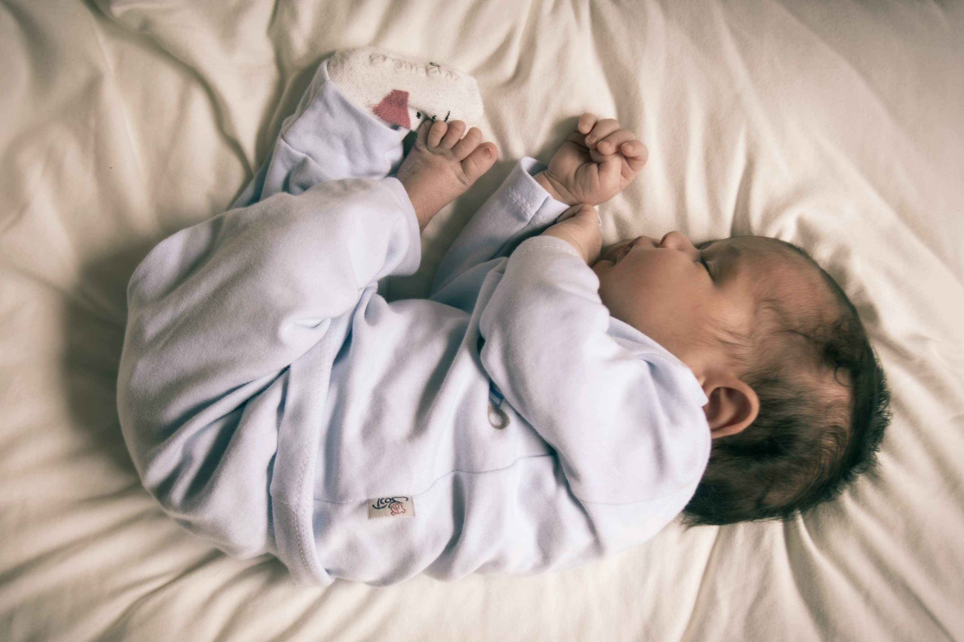 Flat head syndrome: Plagiocephaly and brachycephaly.